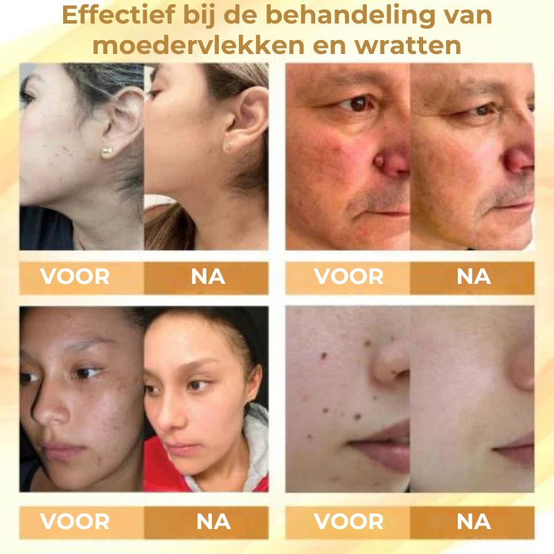 Geconcentreerde herstellende wrattenspray met bijengif