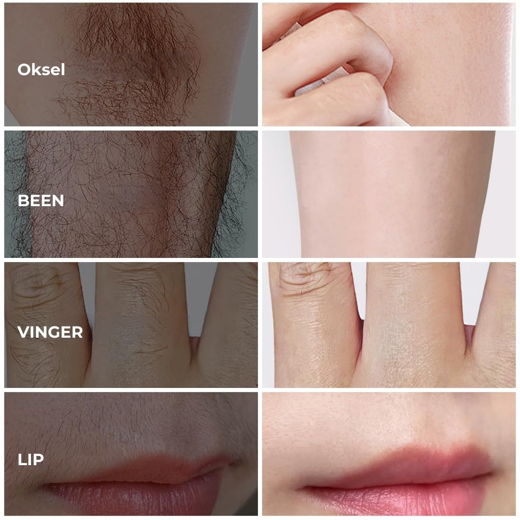 Unisex Haarverwijder Crème