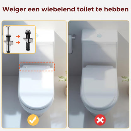 Toilet Bevestigingsbouten - 2 Stuks