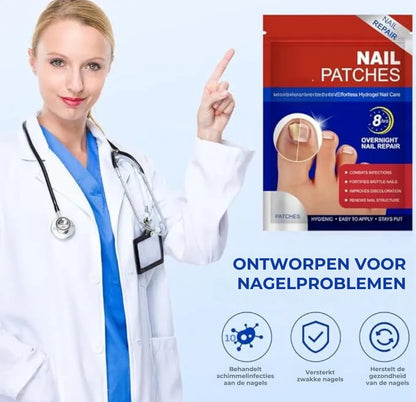 Schimmelnagel Behandelingspleisters – Snelwerkende behandeling voor gezonde nagels