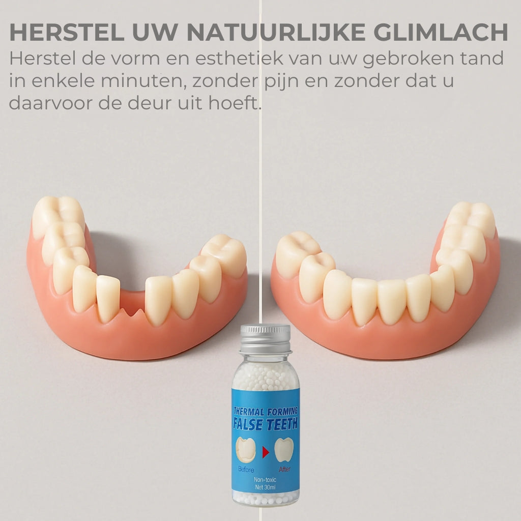 Dentify | Kit voor cosmetische tandheelkundige reparaties