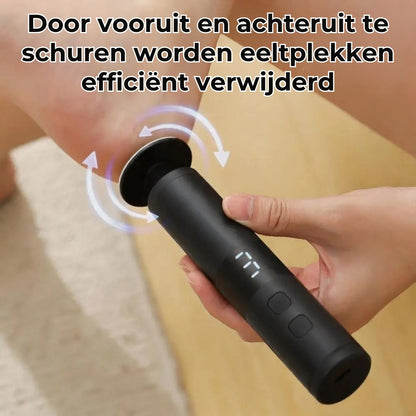 2-in-1 Elektrische Nagelvijl en Eeltverwijderaar
