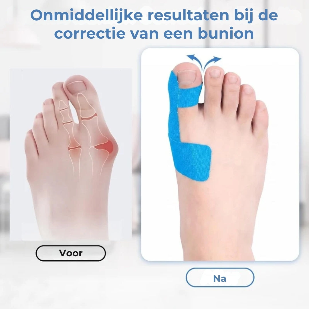 Grote Teen Correctietape - 10 Stuks
