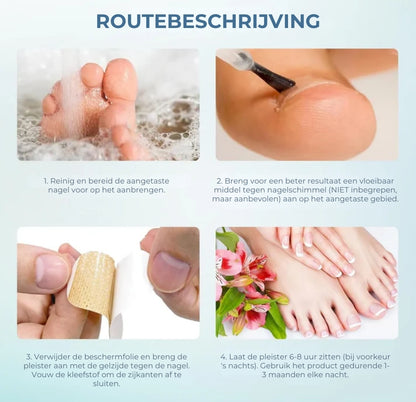Schimmelnagel Behandelingspleisters – Snelwerkende behandeling voor gezonde nagels