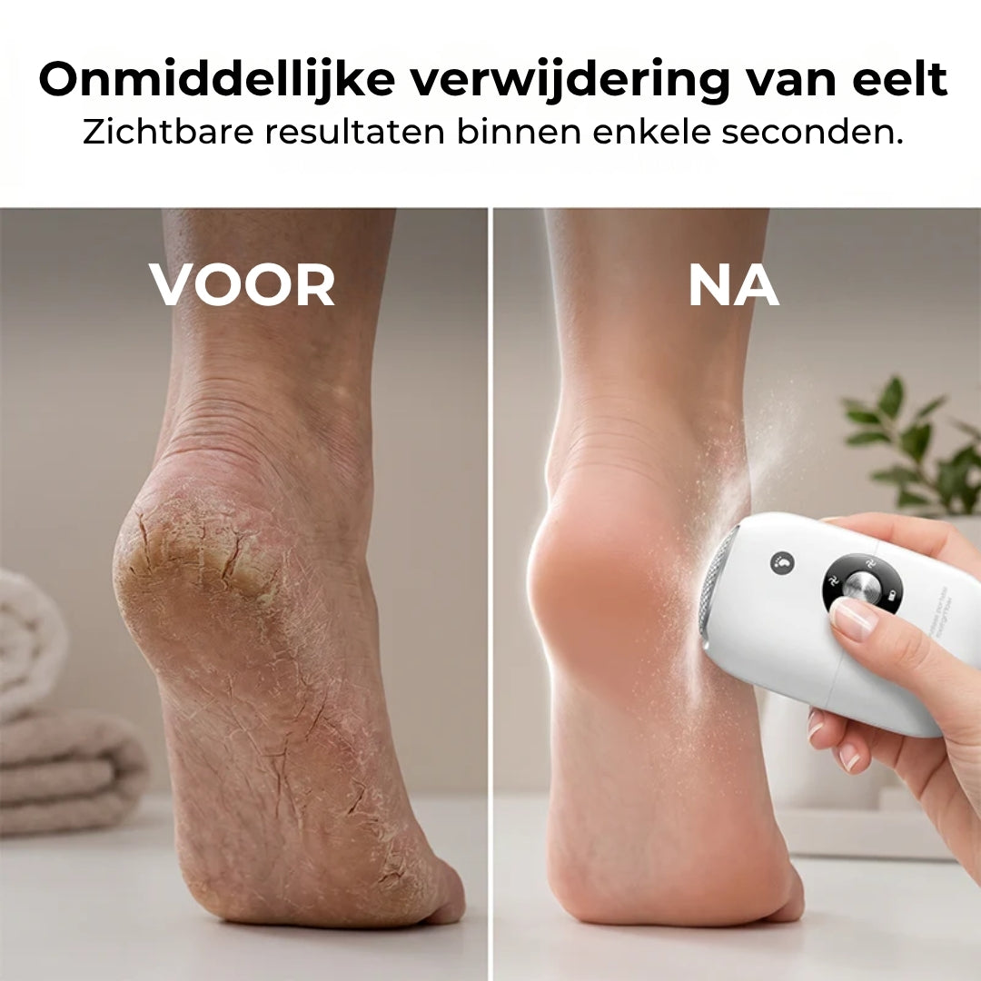 Automatische Pedicureslijpmachine