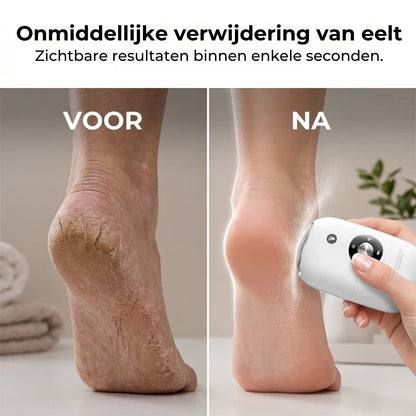 Automatische Pedicureslijpmachine