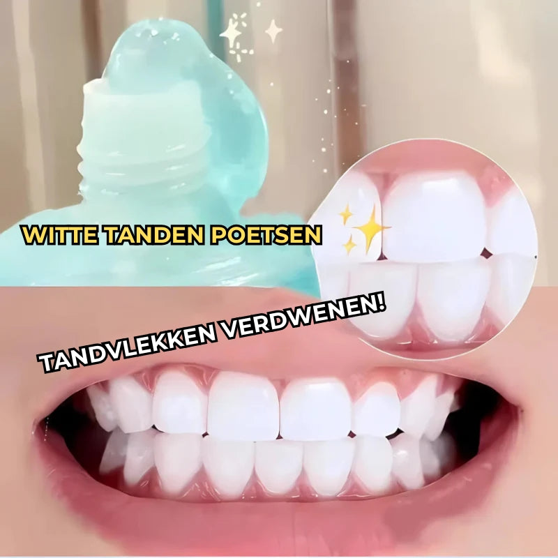 Niacinamide-tandpasta voor het bleken en verwijderen van vlekken