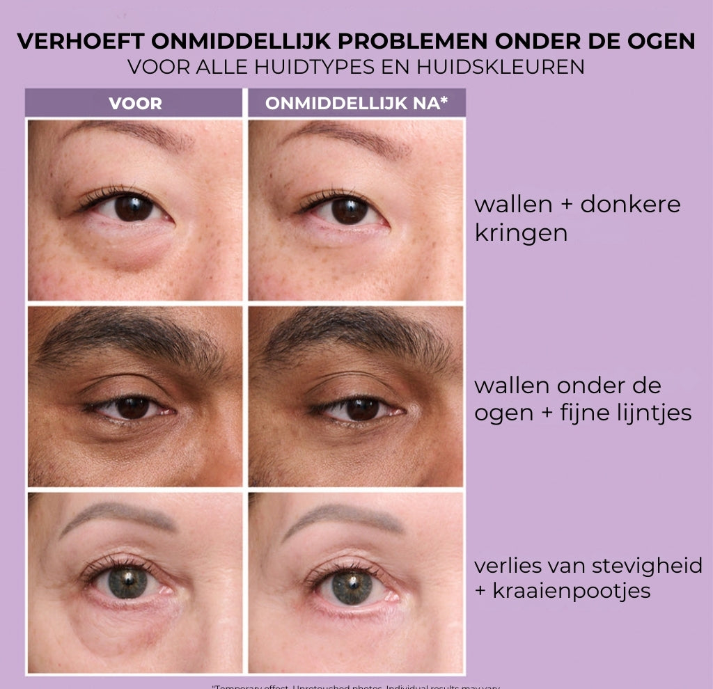 Perfectie Primer Tightener – Nieuwe formule, maximale lifting en gladde finish