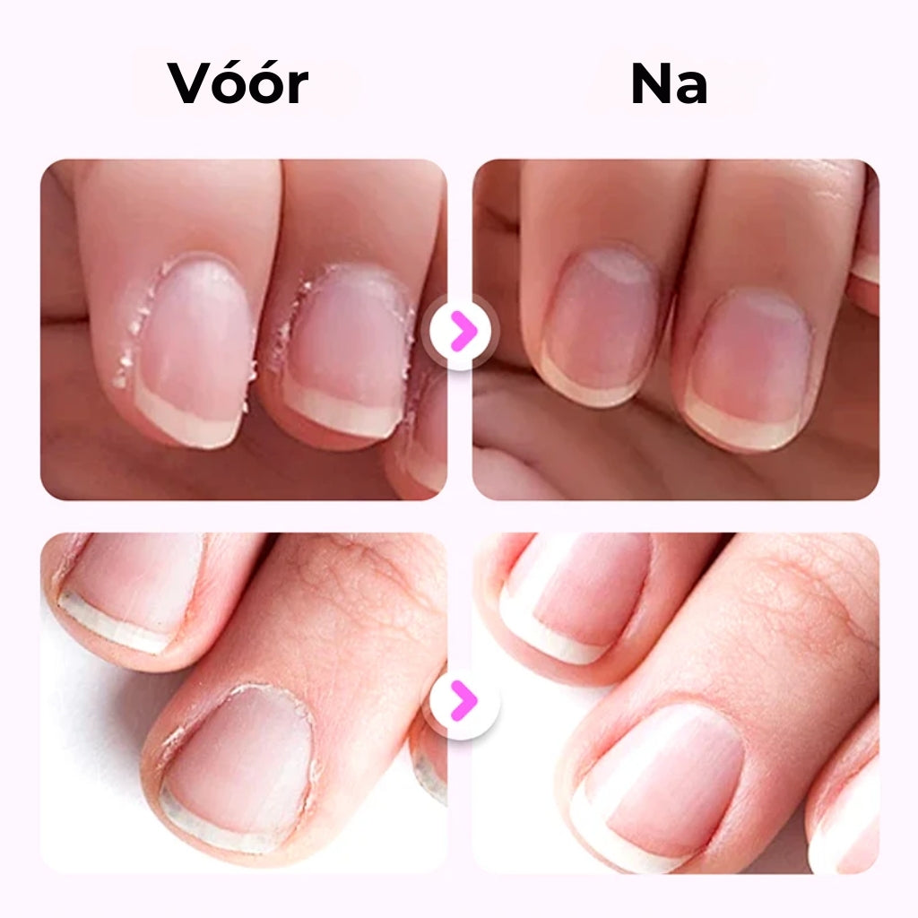 💅 3-in-1 Nagelverzorgingspen 2026