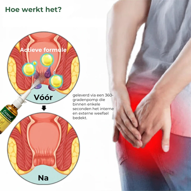 Cvreoz Pro® Snelwerkende kruidenspray tegen aambeien