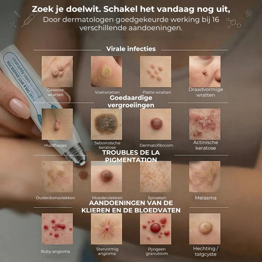 Geavanceerde Roller voor het verwijderen van Huidtags en Wratten