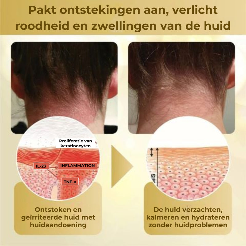 Geconcentreerde herstellende wrattenspray met bijengif