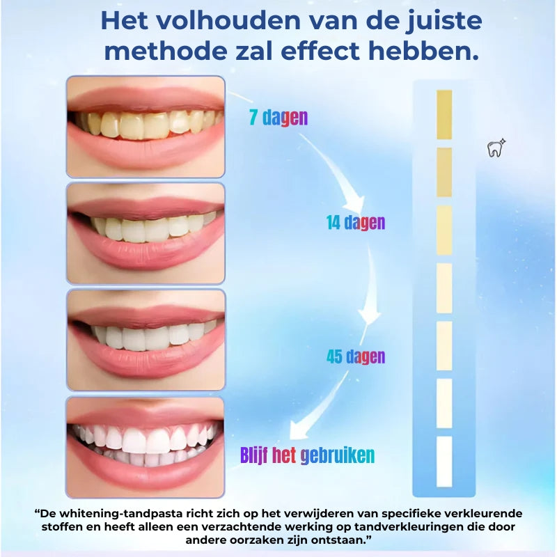 Niacinamide-tandpasta voor het bleken en verwijderen van vlekken