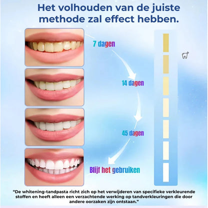 Niacinamide-tandpasta voor het bleken en verwijderen van vlekken